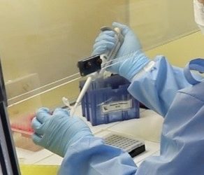 Testes RT-PCR são muito sensíveis e foram realizadas em amostras colhidas do esgoto de Florianópolis em 27 de novembro de 2019. Foto: LVA/UFSC